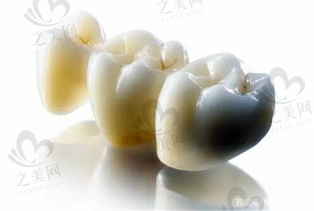 2023银川all-on-4全口种植牙科医院前10上榜清单(宁夏银川诺贝尔口腔门诊部实力不接受反驳！)