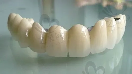 无锡恒牙齿治疗口碑好的医院前十排行榜(无锡佳士洁口腔倾力推荐)