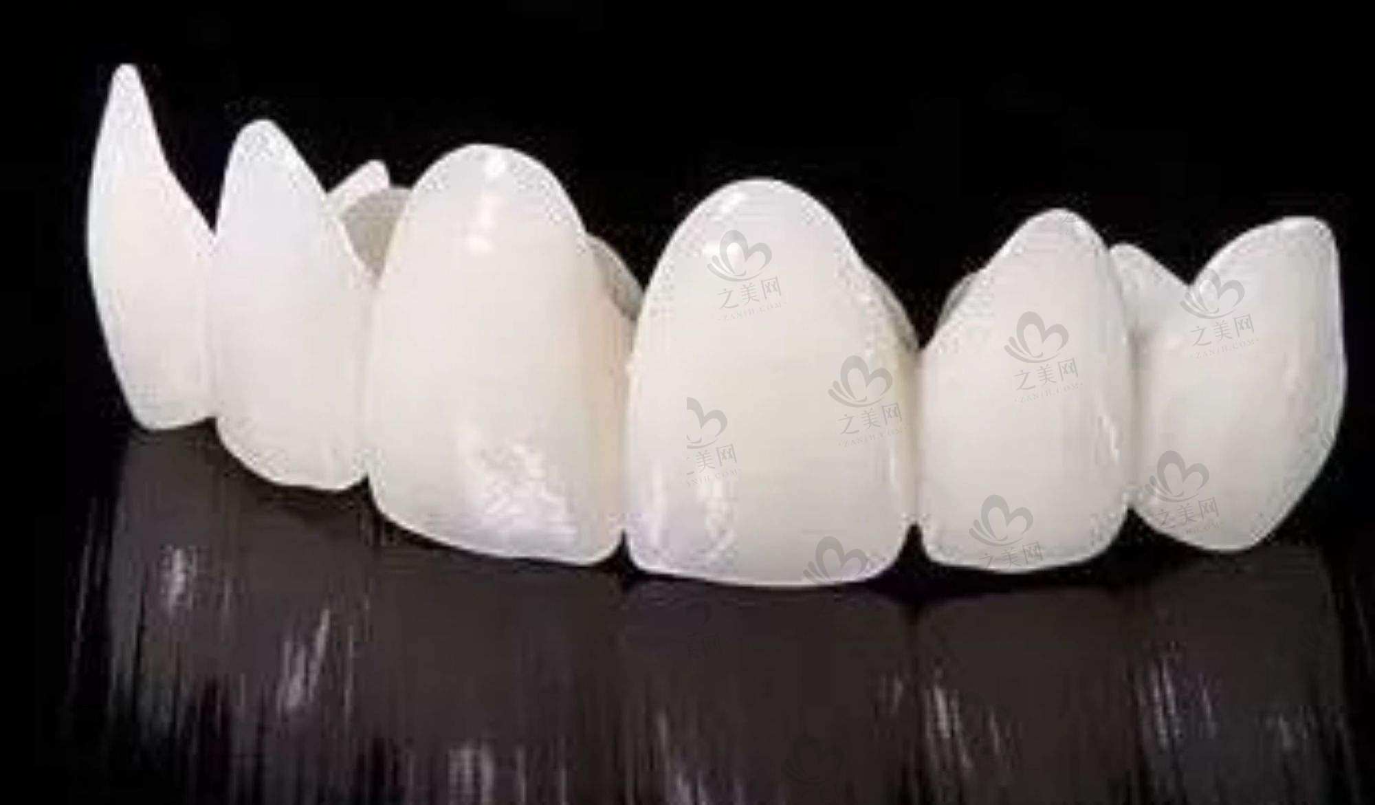 2023北京做牙齿贴片好的口腔医院排名前十，汇总北京牙贴面好的正规牙科