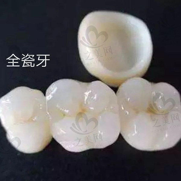 浙江收牙齿牙弓变窄口腔美容医院榜单前10(浙江医科大学入榜)