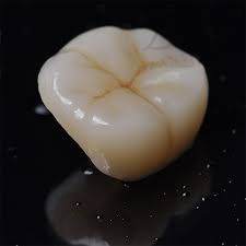 2023宁波种植牙植体榜单top10齿科医院(宁波北仑现代口腔是行业翘楚)