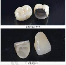 2023南昌高位智齿拔除口腔医院榜单前十,南昌彭爱秀琪口腔荣登榜
