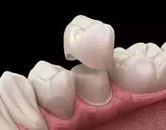 2023青岛牙齿矫正口腔医院排名前十
