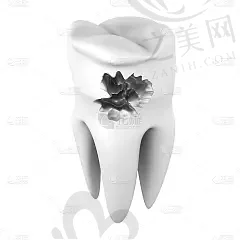 2023宁波牙骨粉填充口腔美容医院排名前十出炉:美呀植联性价比高