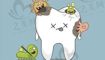 2023武汉牙齿残根根管治疗口碑10强牙科医院(武汉江城口腔技术很拔尖)