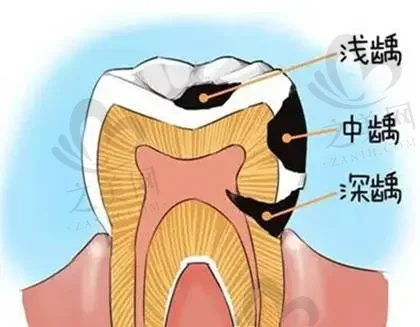 2023西安牙龈萎缩值牙齿科医院排名前10强(西安林牙立齿口腔锁定前四强)
