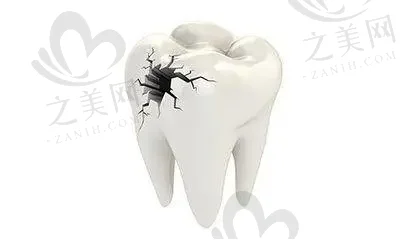2023中山牙龈整形口腔医院口碑排行前10(中山禾佳口腔上榜)