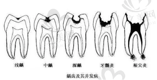 2023成都根尖牙炎在榜名单前<span style=