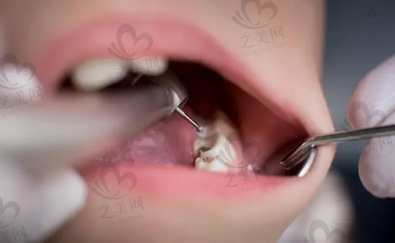 西安联邦口腔医院牙齿矫正
