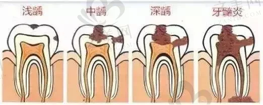 2023淄博深覆合牙齿矫正医院排名前十,上榜的都是正规优质好牙科