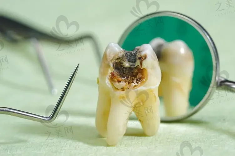 2023郑州种植牙比较好的口腔医院
