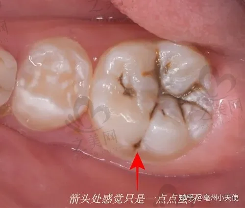 2023湖州种植牙排行前十位口腔医院,口碑好人气高的前十名榜单公布