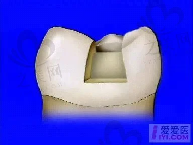 23青岛后牙桩核冠修复口腔医院榜前10强,为您揭秘医疗行业新动向