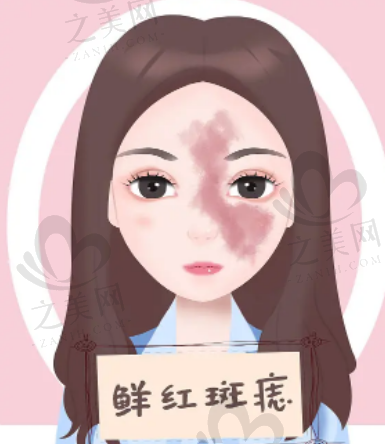 丽江东美整形双眼皮做的怎么样?正规并且有着齐资质和齐全证件的医院
