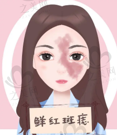 男人如何减肥？两种瘦掉大肚子的方法介绍！