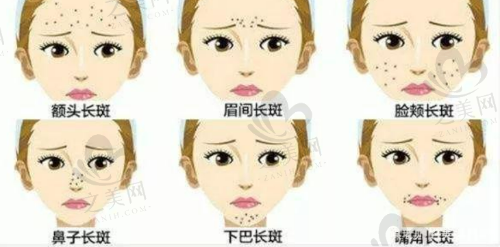 三河市医院做个全切双眼皮多少钱