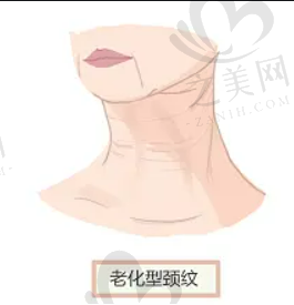 邯郸正规植发医院推荐，女性植发术后果反馈