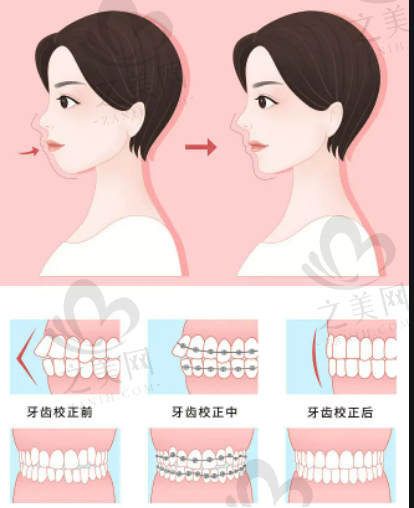 香港九龙医院做双眼皮好吗