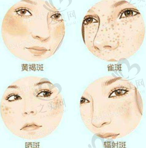 郭鑫割双眼皮怎么样?一直就职于八大处整形外科医院,从业逾20年