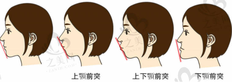 北京大学深圳医院整形科怎么样？技术测评、外科医生等在线一览！