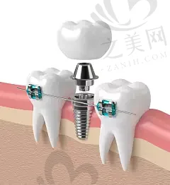 杭州新缘口腔门诊部