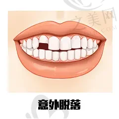 2023温州儿童龅牙排名前十齿科医院(温州鹿城爱牙故事口腔门诊部医院/科室人气对比选择)