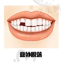2023长沙种植牙口腔医院排名前十:牙大夫/牙祖/循力源口碑技术超好