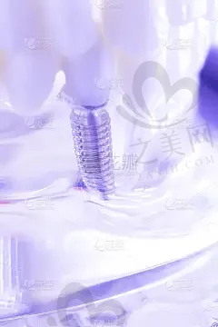 2023浙江种植牙较好的医院排名前十:美奥/柯桥/医科大口腔科实力强