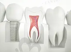 2023上海瑞士ITI(士卓曼)种植牙齿科医院<span style=