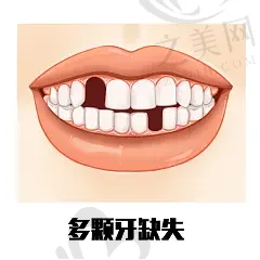 2023南京根尖未闭合根管治疗齿科医院评价前10名(南京江宁小松鼠口腔门诊部技术专业审美在线)
