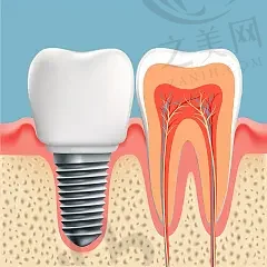 上海牙槽骨内侧凸起口腔医院综合实力排名