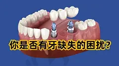 2023宜昌奥齿泰种植体口碑前十位齿科医院(宜昌博莱美口腔门诊口碑突出入选)