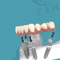 2023浙江种一棵牙口腔医院在榜清单top10强(浙江杭州美奥口腔实力强)