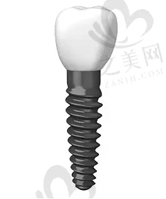2023年浙江省口腔美容冠烤瓷牙排名出炉,速来看哪家非常适合你