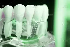 2023南京半口ABT种植牙正规齿科医院排名榜10强(南京施尔美口腔上榜！)