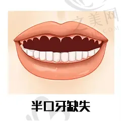 台州牙弓宽矫正排名榜top10齿科医院