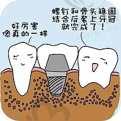 2023广州牙骨重建医院排名前十名揭晓!半口|全口种植技术强
