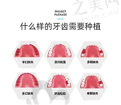 2023上海全瓷冠美容修复口腔美容医院排行top10强(上海薇琳口腔等实力汇总)