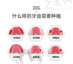2023镇江正雅正美悦享版隐形矫正哪些医院好?盘点口碑医院前十