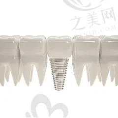北京舌刺矫正器齿科医院在榜名单前10名