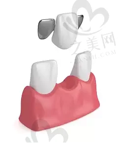 新乡烤瓷冠口碑排名前10强牙科(口腔科医师名单+收费明细表更新)