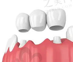 2023山东牙齿矫正医院排名前十已公布,了解一下山东牙齿正畸哪家医院好