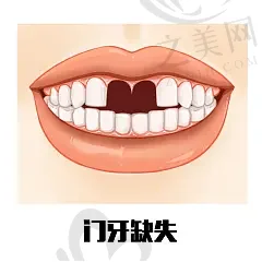 2023云南假牙口腔医院排名前十,半口/全口假牙正规好医院附价格表